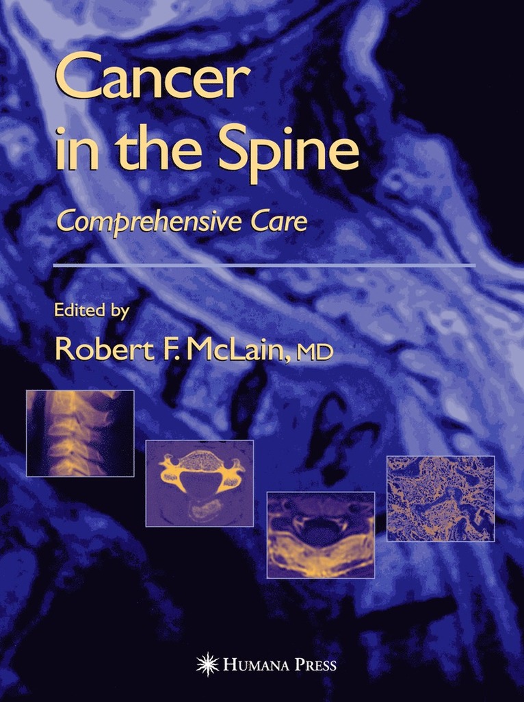 Robert F. McLain, Robert F. McLain, Maurie Markman, Ronald M. Bukowski, Roger Macklis, Edward C. Benzel, M.D. Markman, Maurie, Robert F McLain, Ronald M Bukowski, Edward C Benzel - Cancer in the Spine, Inbunden