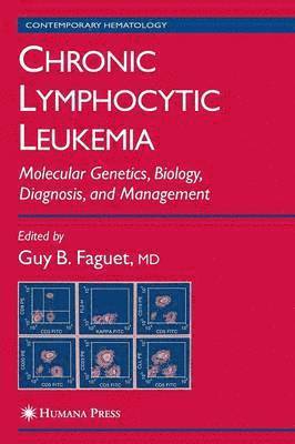 Chronic Lymphocytic Leukemia 1