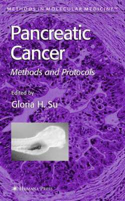 Gloria H. Su, Gloria H Su - Pancreatic Cancer, Inbunden