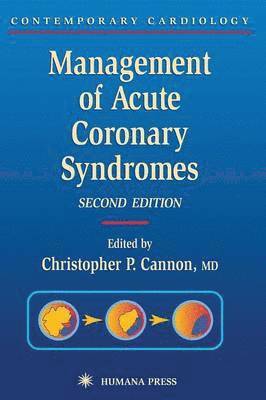 bokomslag Management of Acute Coronary Syndromes