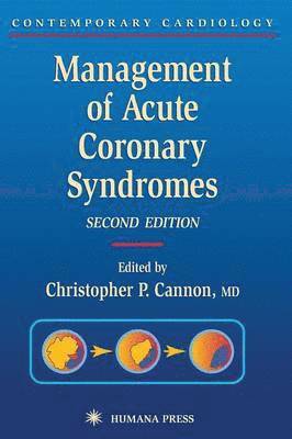 Management of Acute Coronary Syndromes 1