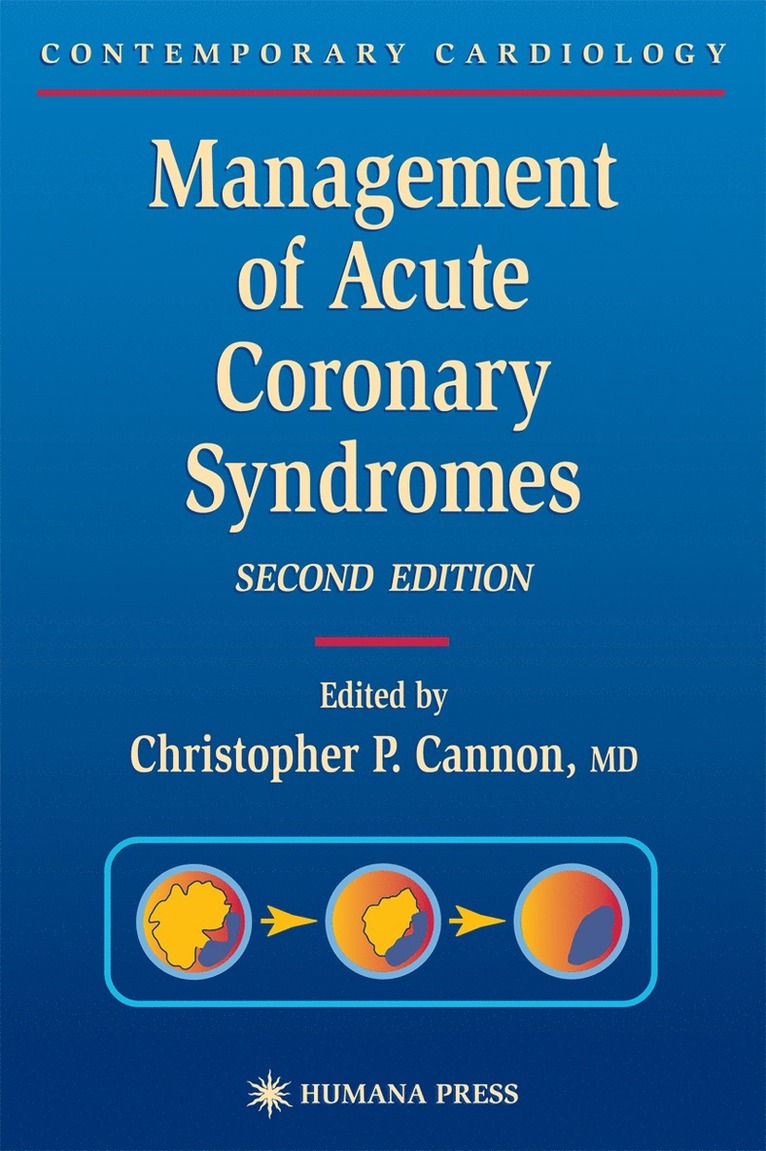 Christopher P. Cannon, Christopher P. Cannon - Management of Acute Coronary Syndromes, Inbunden