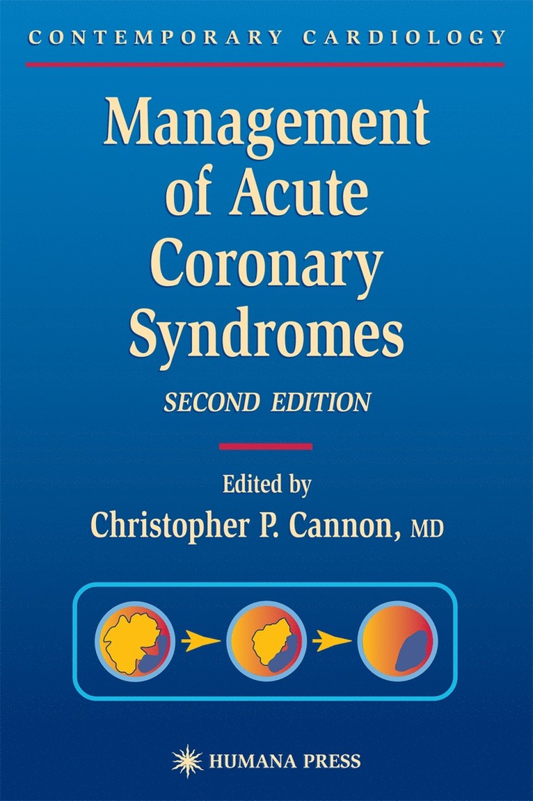 Management of Acute Coronary Syndromes 1