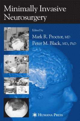 Mark R. Proctor - Minimally Invasive Neurosurgery, Inbunden