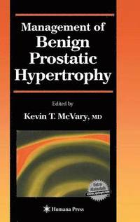bokomslag Management of Benign Prostatic Hypertrophy