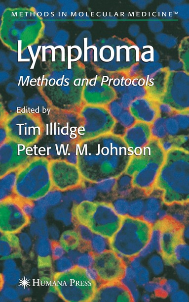 Timothy Illidge, Tim Illidge, Peter W. M. Johnson - Lymphoma, Inbunden