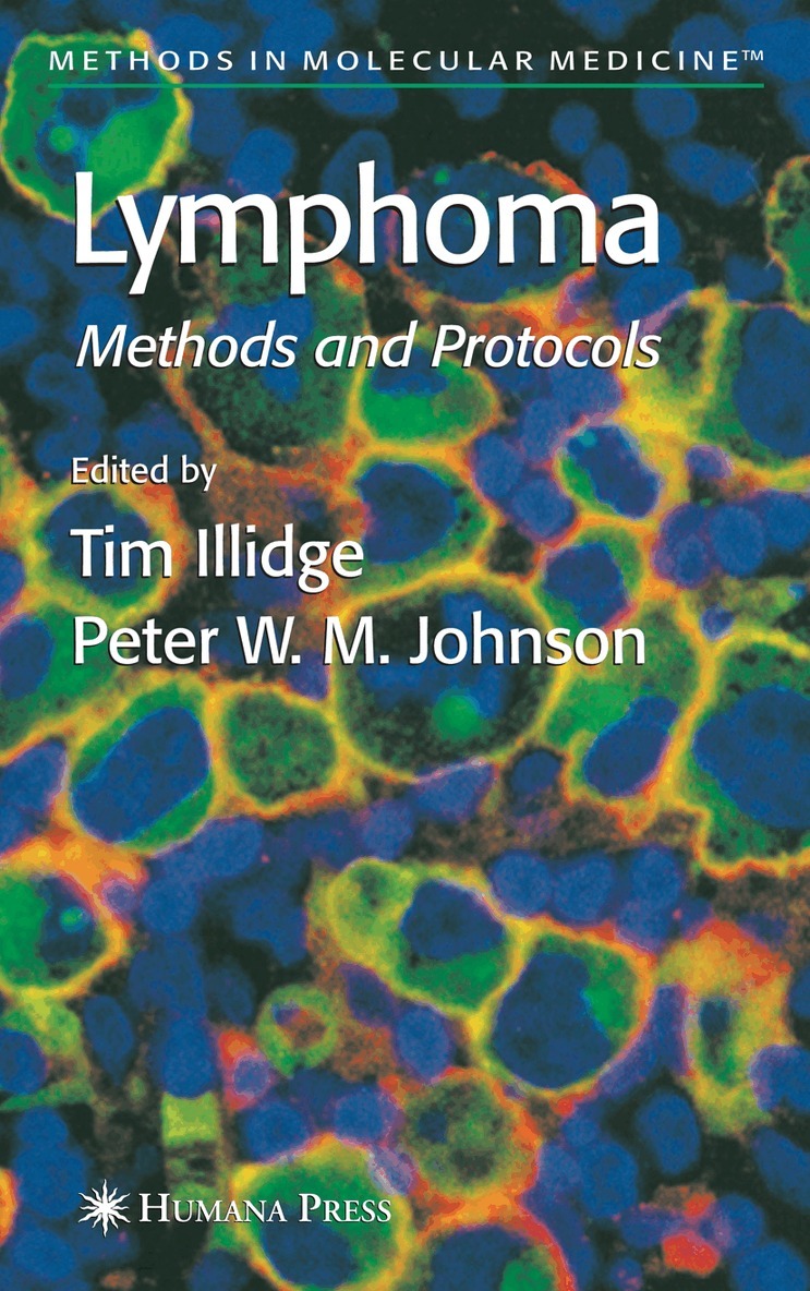Timothy Illidge, Tim Illidge, Peter W. M. Johnson - Lymphoma, Inbunden