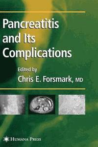 bokomslag Pancreatitis and Its Complications