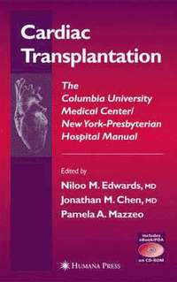 bokomslag Cardiac Transplantation