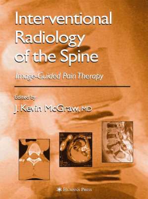 bokomslag Interventional Radiology of the Spine