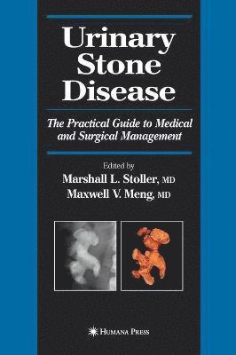 bokomslag Urinary Stone Disease