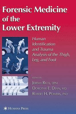 bokomslag Forensic Medicine of the Lower Extremity