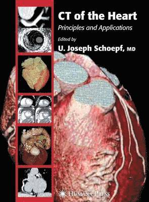 U. Joseph Schoepf - CT of the Heart: Principles and Applications, Inbunden