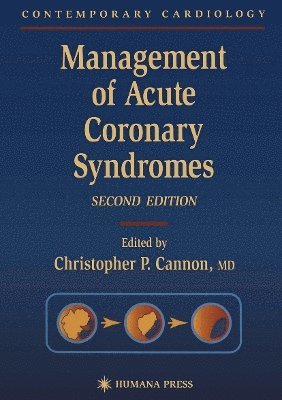 bokomslag Management of Acute Coronary Syndromes