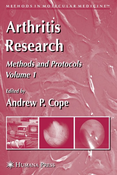 bokomslag Arthritis Research