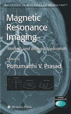 Pottumarthi V. Prasad, Pottumarthi V Prasad - Magnetic Resonance Imaging, Inbunden