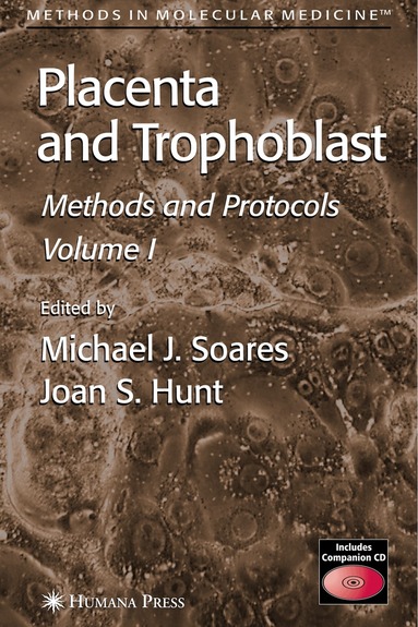 Michael J. Soares, Joan S. Hunt - Placenta and Trophoblast, Inbunden