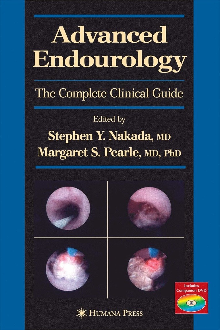Advanced Endourology