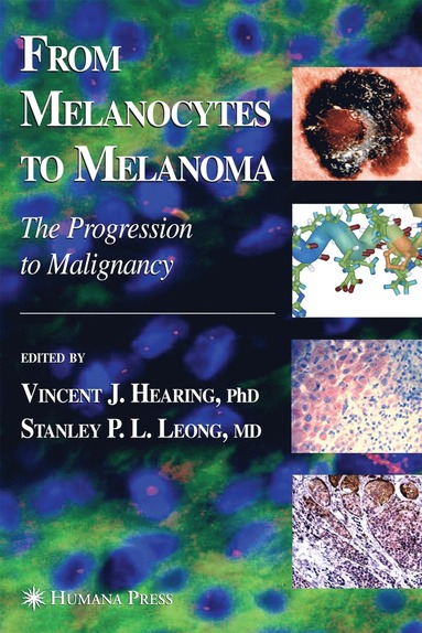 bokomslag From Melanocytes to Melanoma