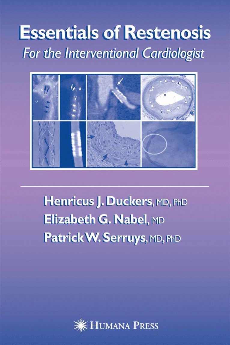 Henricus J. Duckers, Elizabeth G. Nabel, Patrick W. Serruys - Essentials of Restenosis, Inbunden
