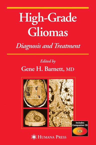 bokomslag High-Grade Gliomas