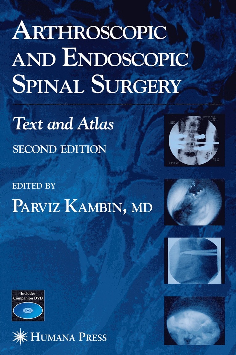 Arthroscopic and Endoscopic Spinal Surgery 1