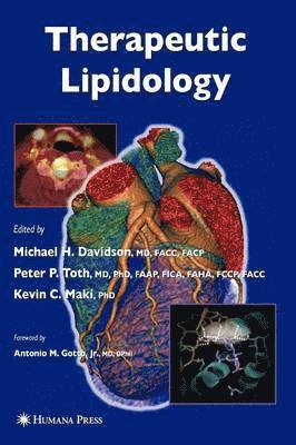 Therapeutic Lipidology 1