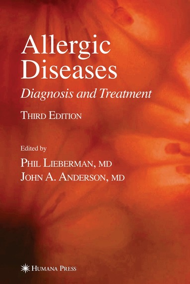 Phil Lieberman, John A. Anderson - Allergic Diseases, Inbunden