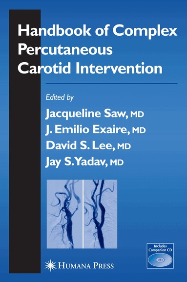 Jacqueline Saw, Jose Exaire, David S. Lee, Sanjay Yadav - Handbook of Complex Percutaneous Carotid Intervention, Inbunden