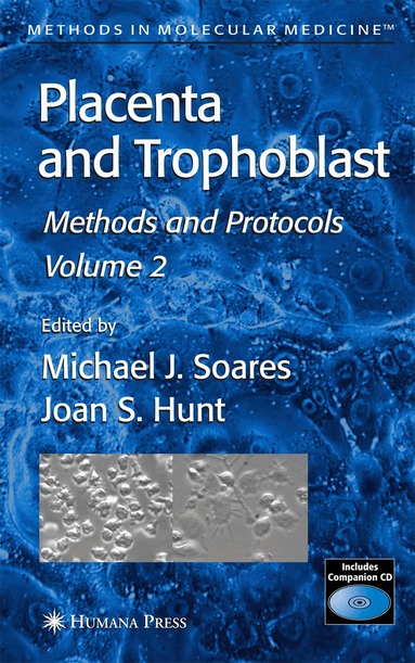 Michael J. Soares, Joan S. Hunt - Placenta and Trophoblast, Inbunden