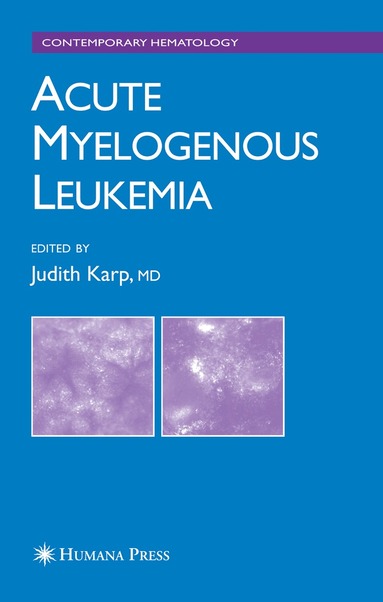 Judith E. Karp - Acute Myelogenous Leukemia, Inbunden