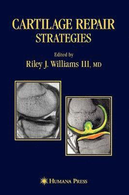 Cartilage Repair Strategies 1