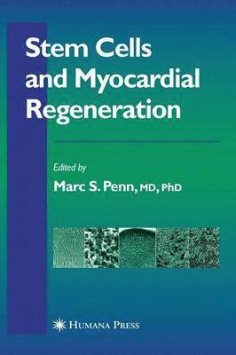 bokomslag Stem Cells and Myocardial Regeneration