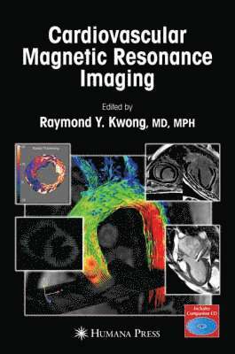 Cardiovascular Magnetic Resonance Imaging [With CDROM]