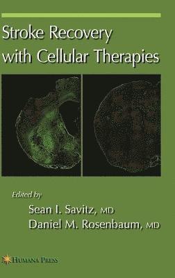 Stroke Recovery with Cellular Therapies