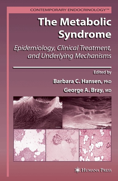Barbara C. Hansen, George A. Bray - Metabolic Syndrome:, Inbunden