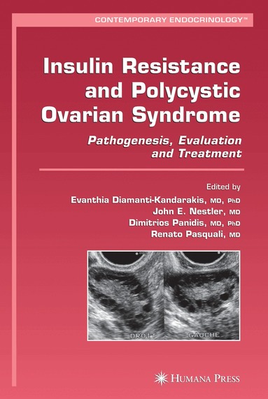 Evanthia Diamanti-Kandarakis, John E. Nestler, Dimitrios Panidis, Renato Pasquali - Insulin Resistance and Polycystic Ovarian Syndrome, Inbunden