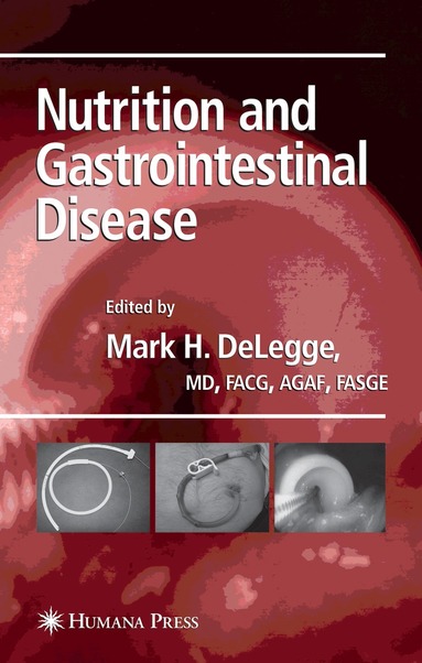 Mark DeLegge - Nutrition and Gastrointestinal Disease, Inbunden