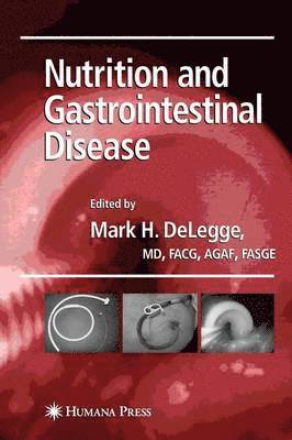 bokomslag Nutrition and Gastrointestinal Disease