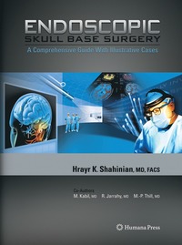 bokomslag Endoscopic Skull Base Surgery