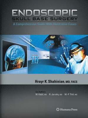 bokomslag Endoscopic Skull Base Surgery