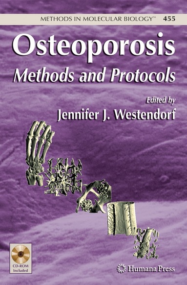 Jennifer Westendorf - Osteoporosis, Inbunden