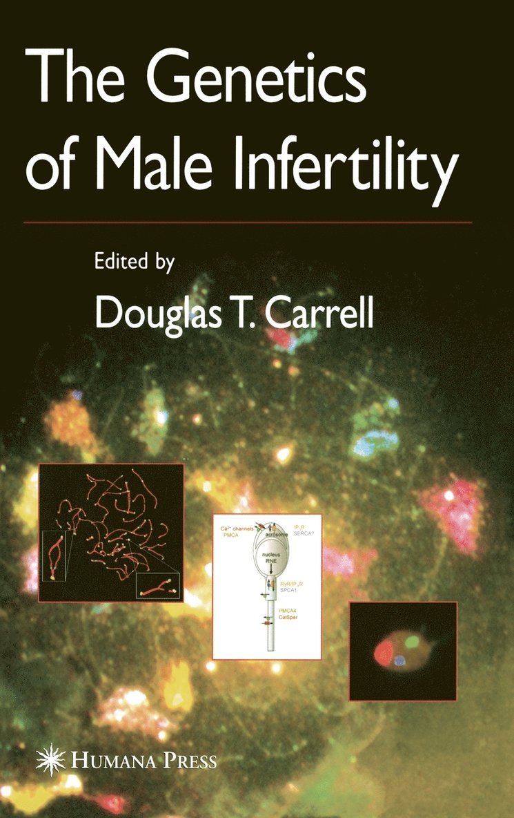 The Genetics of Male Infertility 1