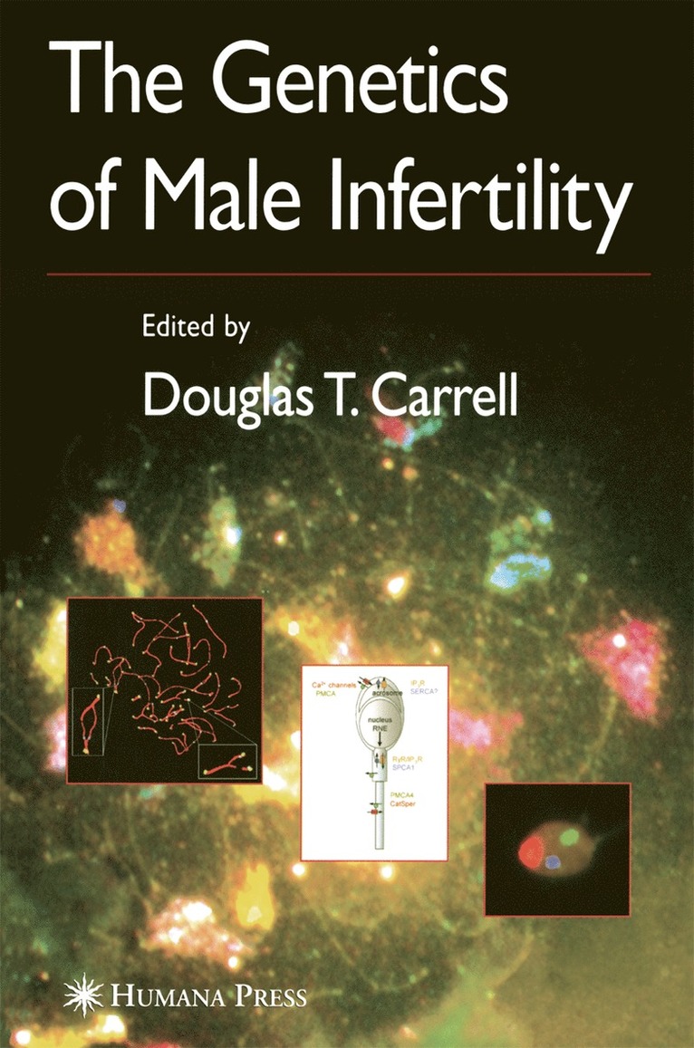 Douglas T. Carrell, Douglas T. Carrell, Douglas T Carrell - Genetics of Male Infertility, Inbunden