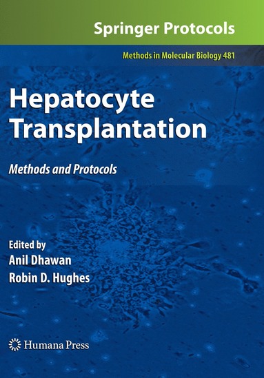 bokomslag Hepatocyte Transplantation