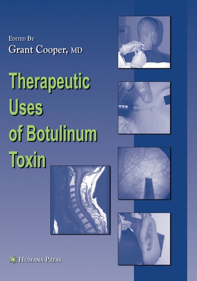 bokomslag Therapeutic Uses of Botulinum Toxin