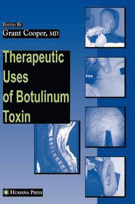 Therapeutic Uses of Botulinum Toxin 1