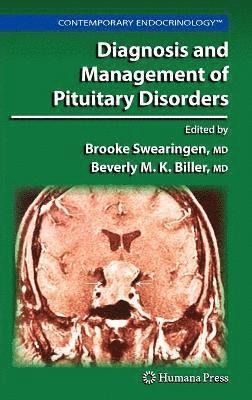 Diagnosis and Management of Pituitary Disorders