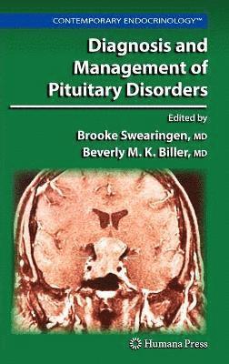 Diagnosis and Management of Pituitary Disorders 1