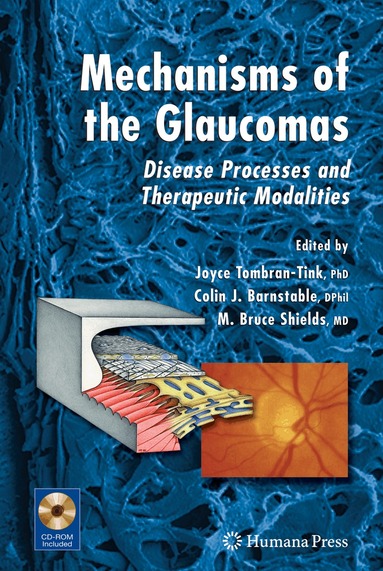 Joyce Tombran-Tink, Colin J. Barnstable, M. Bruce Shields - Mechanisms of the Glaucomas, Inbunden
